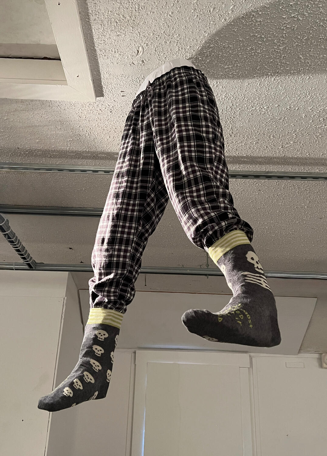 Legs